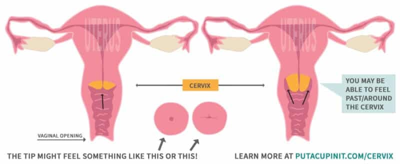 How To Find Your Cervix: Illustration of the uterus with cervix highlighted