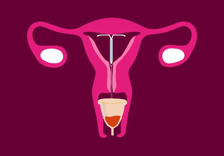 Can you use Menstrual Cups with IUDs? Put A Cup In It