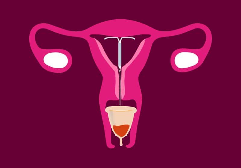 Uterus with IUD and mentrual cup