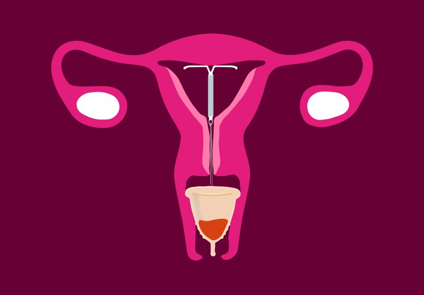 Can you use Menstrual Cups with IUDs? Put A Cup In It