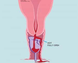 Why is My Menstrua Cup Leaking? Easy Fixes to Avoid Future Leaks!