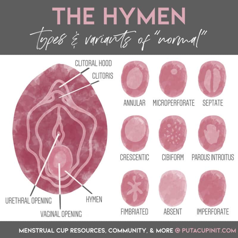How To Know If Hymen Has Been Broken How To Know If Hymen Has Been Broken