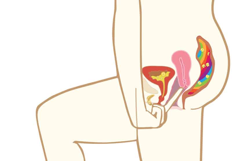 Illustration of finding your cervix by put a cup in it
